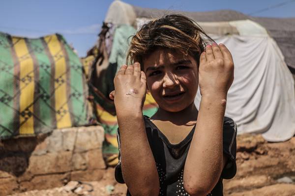 Foto - İdlib'de büyük tehlike! "Durum içler acısı"