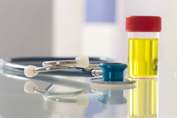 Foto - İdrarınızın rengi böyleyse dikkat