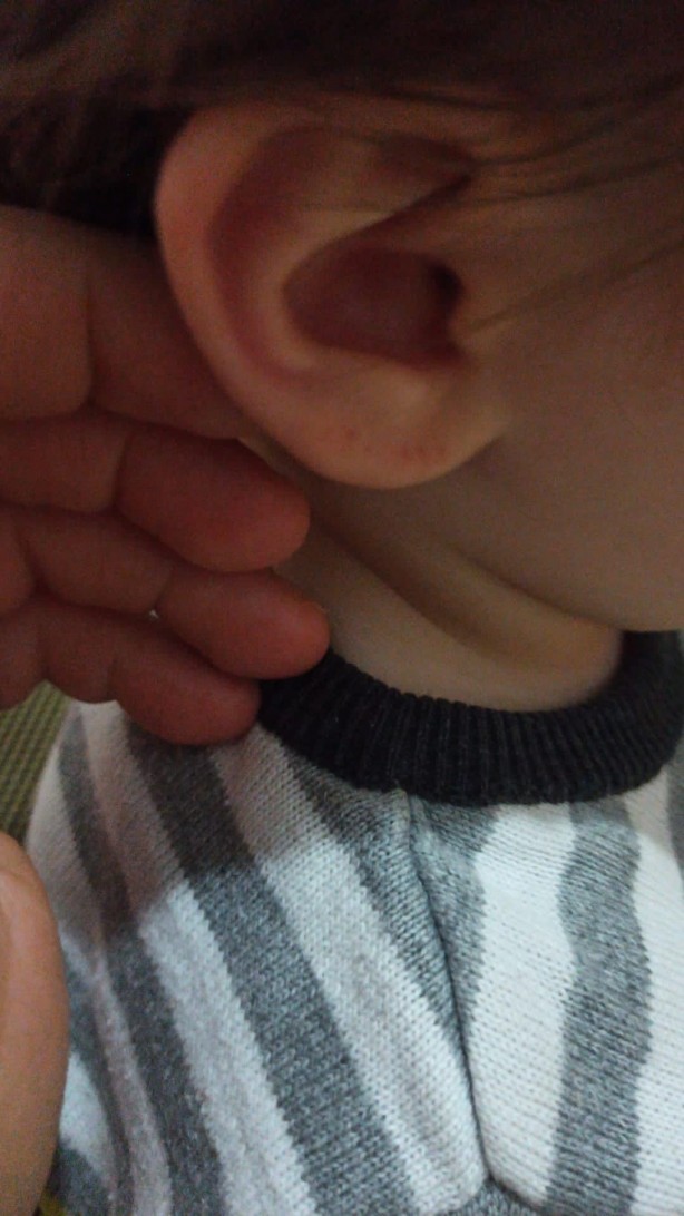 Foto - Iğdır'da akılalmaz olay! Eve giren yarasa iki çocuğun kulağını ısırdı