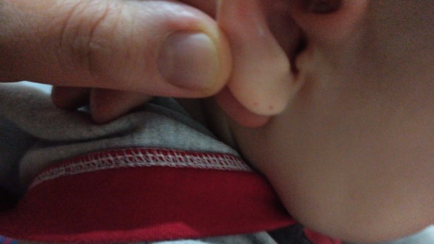 Iğdır'da akılalmaz olay! Eve giren yarasa iki çocuğun kulağını ısırdı