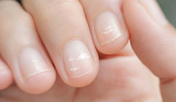 Foto - İhmal edilmemesi gereken 15 hastalık belirtisi