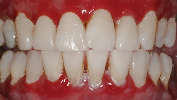 Foto - İhmal edilmemesi gereken 15 hastalık belirtisi