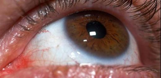 Foto - İhmal edilmemesi gereken 15 hastalık belirtisi