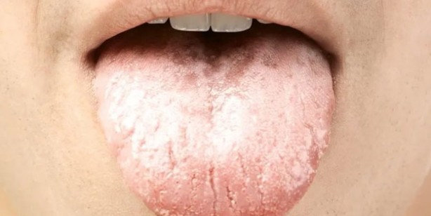 Foto - İhmal edilmemesi gereken 15 hastalık belirtisi