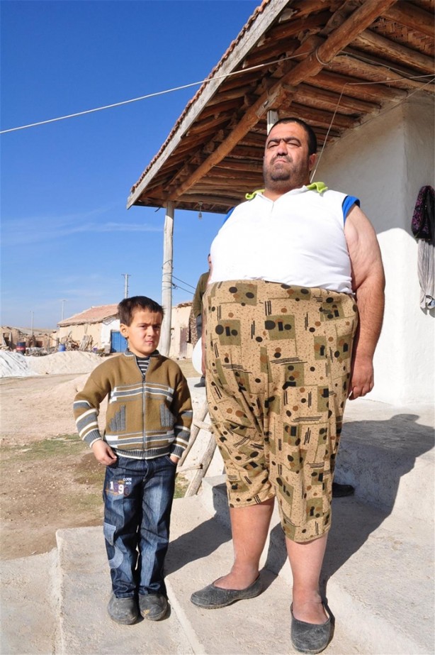 Foto - İki yılda 94 kilo verdi!