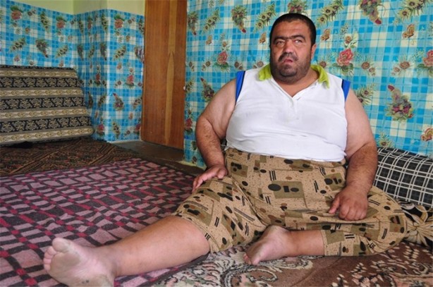 Foto - İki yılda 94 kilo verdi!