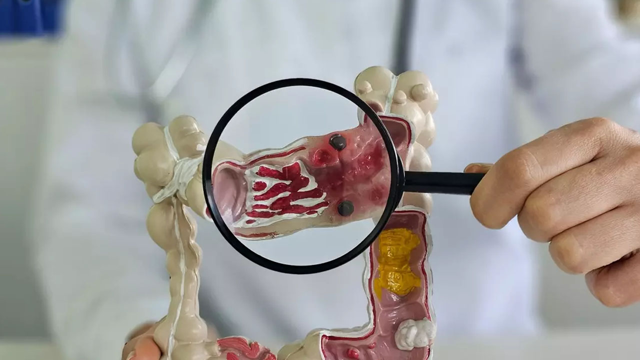 Foto - İkinci beyin bağırsaklar sağlığını hafızanı etkiliyor! Kalp dostu muz: Enerji veren doğal atıştırmalık şaşırtabilir