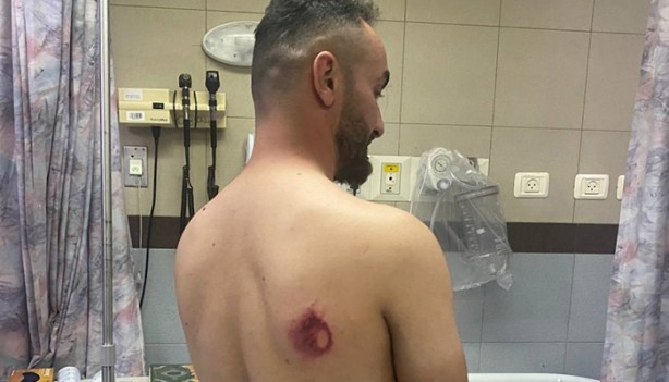 Foto - İkiyüzlü Batı sessiz! Bu görüntüleri unutmayın