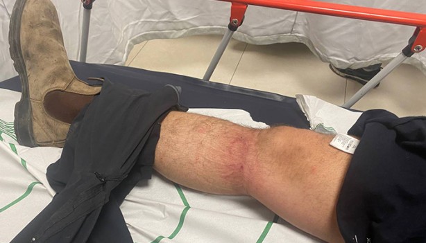 Foto - İkiyüzlü Batı sessiz! Bu görüntüleri unutmayın