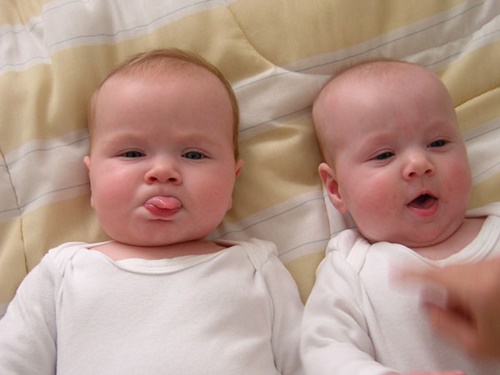 Foto - İkizler hakkında bilmediğiniz 15 şey