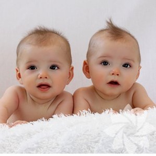 Foto - İkizler hakkında bilmediğiniz 15 şey