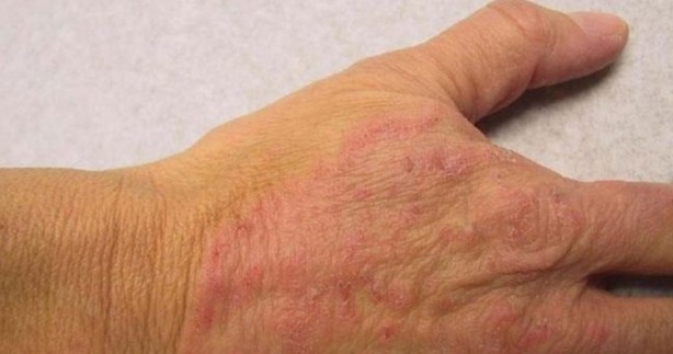 Foto - İlaç olarak kabul ediliyor! Bu gıdayı yediğinizde vücudunuzda...