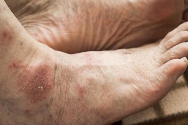 Foto - İlaçtan daha etkili olduğu kanıtlandı! Bu meyveyi 45 tane yerseniz bakın ne olur?