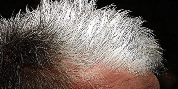 Foto - İlk keşif! Bilim insanları: Saçlardaki beyazlaşmayı tersine çevirme veya önlemeye dair araştırma umut verdi! 