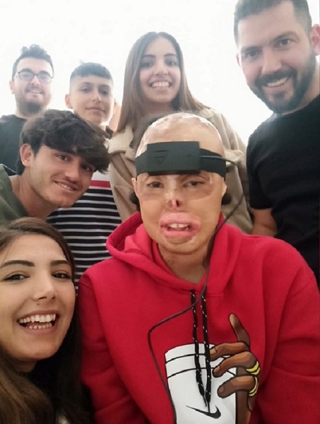 Foto - İlk kez Türkiye'de geliştirildi! Bu gözlük hayatı kolaylaştıracak