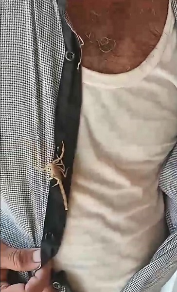 Foto - İnanılır gibi değil! Bakın bu adam kendini neden akreplere sokturdu