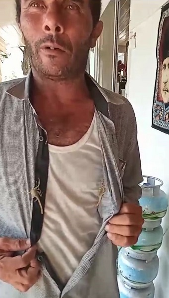 Foto - İnanılır gibi değil! Bakın bu adam kendini neden akreplere sokturdu