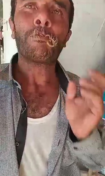 Foto - İnanılır gibi değil! Bakın bu adam kendini neden akreplere sokturdu