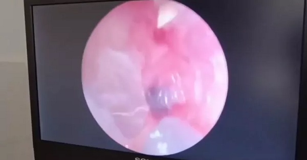 Foto - İnanılır gibi değil | Kadının kulağından öyle bir şey çıktı ki! 