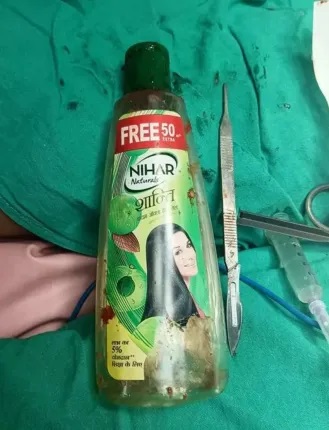 Foto - İnanılmaz bir olay yaşandı | Hastanın midesinden öyle bir şey çıktı ki! 