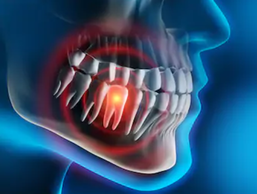 Foto - İnanılmaz faydası var: Diş ağrısı için 2 diş sarımsak!