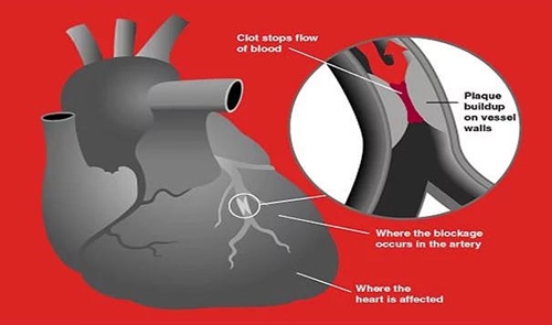 Foto - İnanılmaz tesadüfler