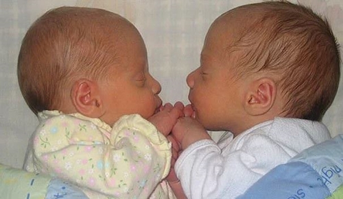 Foto - İnanılmaz tesadüfler