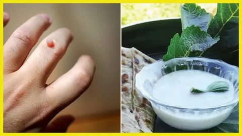 Foto - İncir’in sütü ne işe yarar dedik yıllarca! Bu etkisini keşke daha önce öğrenseydik diyeceksiniz