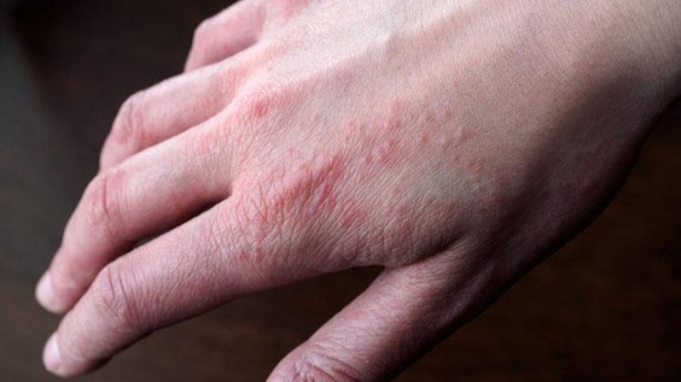 Foto - İncir’in sütü ne işe yarar dedik yıllarca! Bu etkisini keşke daha önce öğrenseydik diyeceksiniz