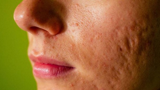 Foto - İncir’in sütü ne işe yarar dedik yıllarca! Bu etkisini keşke daha önce öğrenseydik diyeceksiniz