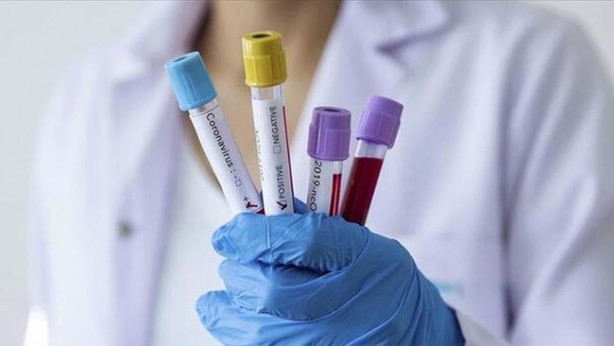 Foto - İngiliz uzmanlar açıkladı! Koronavirüs belirtilerinde yeni detaylar