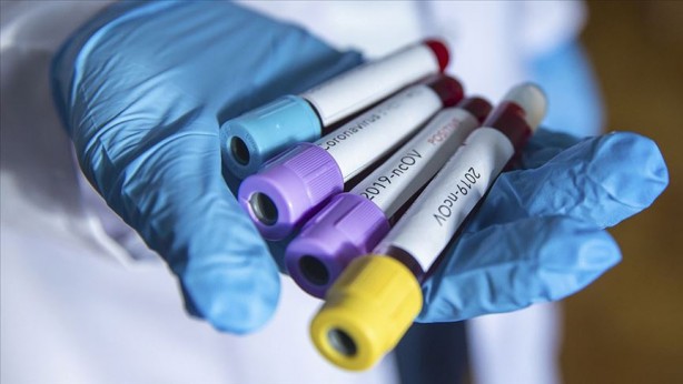 Foto - İngiltere’de son 24 saatte ölenlerin sayısı açıklandı