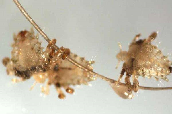 Foto - İnsan vücudunun mikroskobik görüntüleri