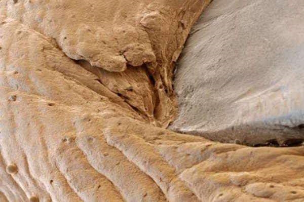 Foto - İnsan vücudunun mikroskobik görüntüleri