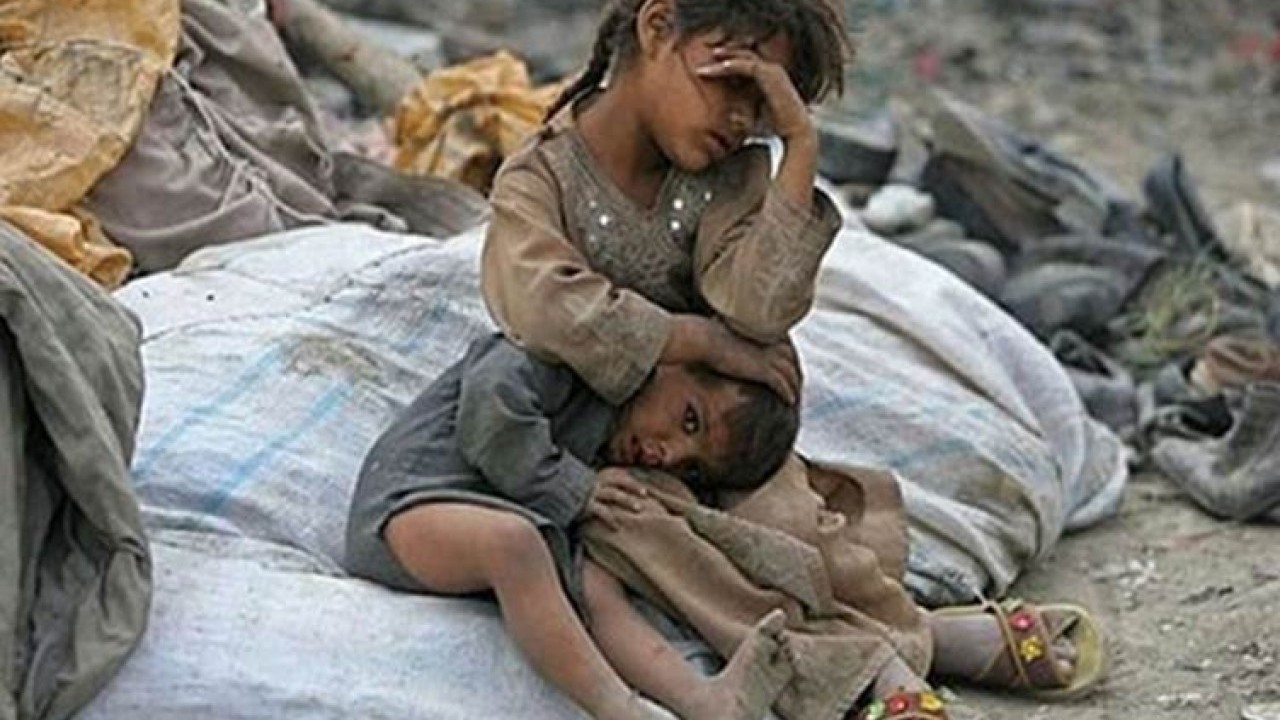 Foto - İnsani trajedinin yaşandığı Yemen'de açlıktan ölümler başladı!