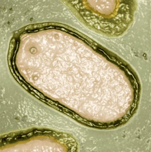 Foto - İnsanları zombiye çevirecek virüs bulundu! Bilim insanları şaşkın