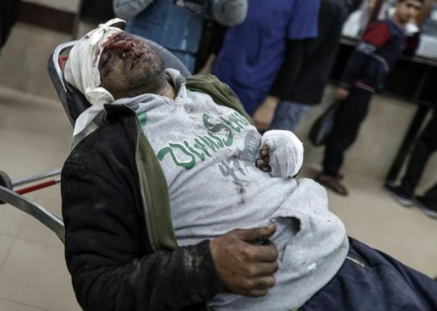 Foto - İnsanlık siyonist çukurunda! Katil İsrail'in Naziler'den farkı yok