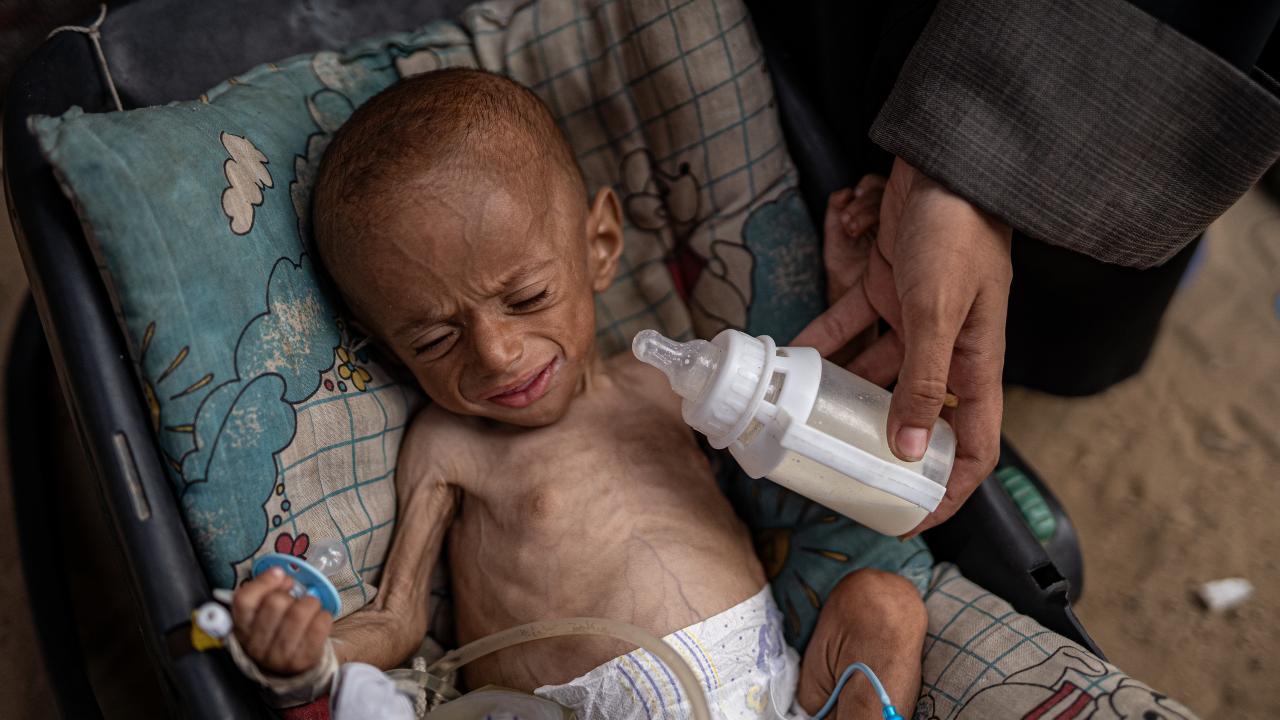 Foto - İnsanlıktan utandıran haber! Biz yemek yerken Gazzeli bebekler...