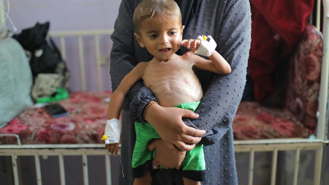 Foto - İnsanlıktan utandıran haber! Biz yemek yerken Gazzeli bebekler...