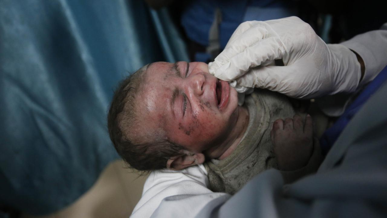 Foto - İnsanlıktan utandıran haber! Biz yemek yerken Gazzeli bebekler...