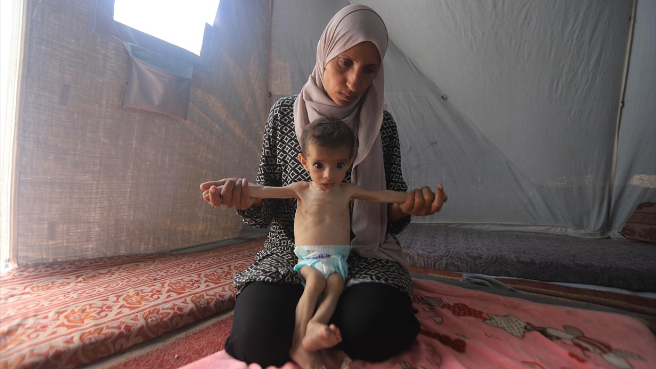 Foto - İnsanlıktan utandıran haber! Biz yemek yerken Gazzeli bebekler...