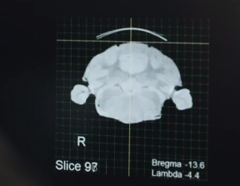 Foto - İnsanoğlu B planını devreye soktu! Dünya tedirgin, bütün çaba ne için?