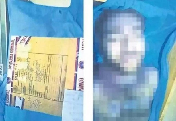 Foto - İntihar ettiği söylenmişti! O fotoğraflar ortaya çıktı 