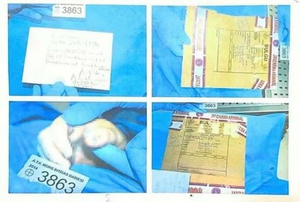 Foto - İntihar ettiği söylenmişti! O fotoğraflar ortaya çıktı 