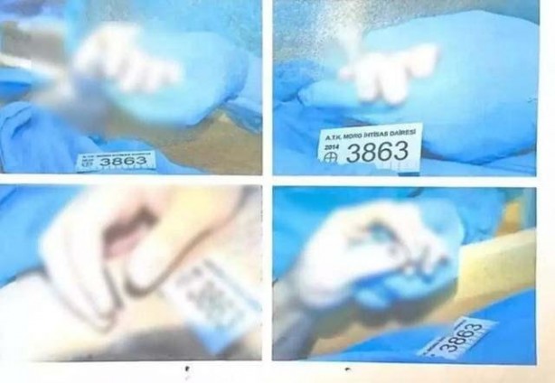 Foto - İntihar ettiği söylenmişti! O fotoğraflar ortaya çıktı 