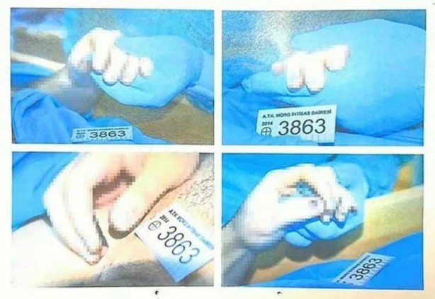 Foto - İntihar ettiği söylenmişti! O fotoğraflar ortaya çıktı 