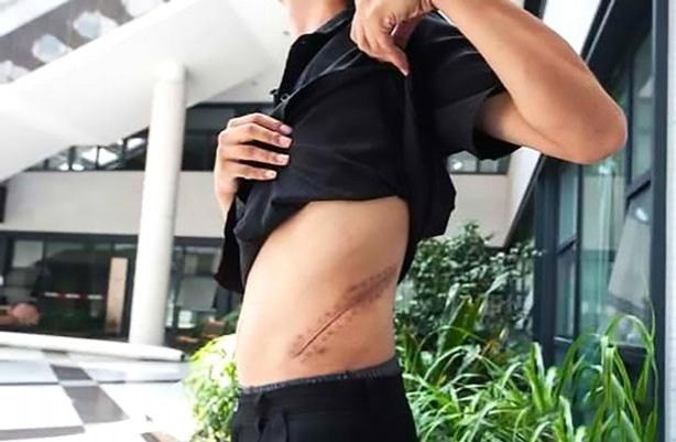 Foto - iPhone alabilmek için böbreğini satan gençten kötü haber