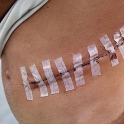 Foto - iPhone alabilmek için böbreğini satan gençten kötü haber