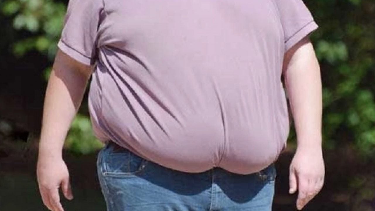 Foto - Obezite sandığınızdan çok daha tehlikeli: Artık bu uyarıya dikkat edin yoksa?!?