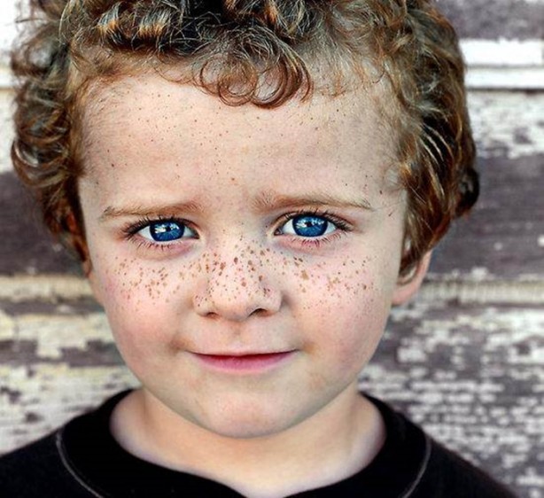 Foto - İri göz bebeklerde o hastalığın habercisi!